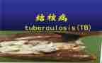 结核防治该工作计划7篇