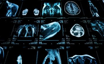 医学影像科个人总结6篇